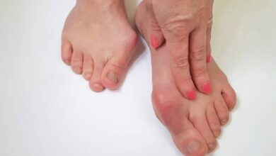 What Is The Importance Of Triple Arthrodesis Foot Surgery?